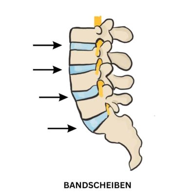yoga gegen rückenschmerzen bandscheiben